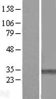 PMM1 Human Over-expression Lysates NM_002676