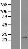 ls005373 pmm2 human over expression lysates nm 000303 wb testing 1