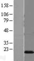 PMP2 Human Over-expression Lysates NM_002677
