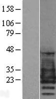 ls005376 pmp22 human over expression lysates nm 000304 wb testing 1