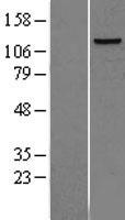POLD1 Human Over-expression Lysates NM_002691