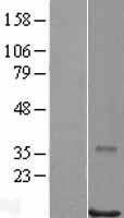 RPB11 (POLR2J) Human Over-expression Lysates NM_006234