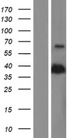 PON2 Human Over-expression Lysates NM_001018161