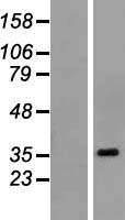 POU6F1 Human Over-expression Lysates NM_002702