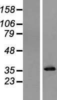 Pyrophosphatase 1 (PPA1) Human Over-expression Lysates NM_021129