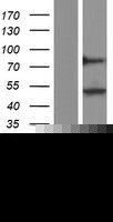 PPAR delta (PPARD) Human Over-expression Lysates NM_001171820