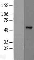 PPAR gamma (PPARG) Human Over-expression Lysates NM_138711