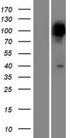 ls005470 ppef2 human over expression lysates nm 006239 wb testing 1
