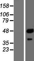 ls005476 ctsa human over expression lysates nm 000308 wb testing 1