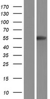 ls005476 ctsa human over expression lysates nm 001167594 wb testing 2