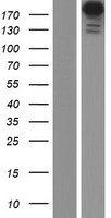Periplakin (PPL) Human Over-expression Lysates NM_002705