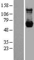 PPM1G Human Over-expression Lysates NM_002707