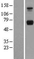 PPM1G Human Over-expression Lysates NM_177983