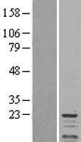 ls005502 protein phosphatase inhibitor 1 ppp1r1a human over expression lysates nm 006741 wb testing 1
