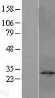 IPP 2 (PPP1R2) Human Over-expression Lysates NM_006241