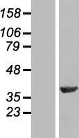 NIPP1 (PPP1R8) Human Over-expression Lysates NM_014110
