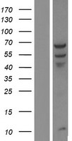 PPP2R1B Human Over-expression Lysates NM_001177562