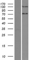 PPP2R3A Human Over-expression Lysates NM_002718