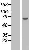 PPP2R3A Human Over-expression Lysates NM_181897