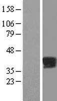 PPP2R4 (PTPA) Human Over-expression Lysates NM_021131