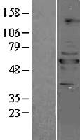 PPP2R5B Human Over-expression Lysates NM_006244