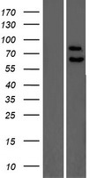 PPP2R5C Human Over-expression Lysates NM_002719