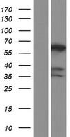 PPP3CB Human Over-expression Lysates NM_001142353