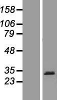 PRB1 Human Over-expression Lysates NM_199354