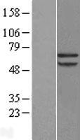 Papillary renal cell carcinoma (PRCC) Human Over-expression Lysates NM_005973