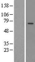PRCP Human Over-expression Lysates NM_005040