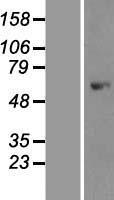 AMPK alpha 1 (PRKAA1) Human Over-expression Lysates NM_006251