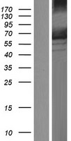AMPK alpha 1 (PRKAA1) Human Over-expression Lysates NM_206907