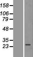AMPK beta 2 (PRKAB2) Human Over-expression Lysates NM_005399