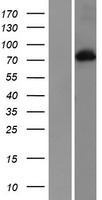PKC alpha (PRKCA) Human Over-expression Lysates NM_002737