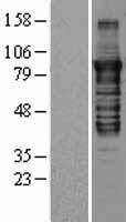 PKC epsilon (PRKCE) Human Over-expression Lysates NM_005400
