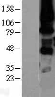 PKC eta (PRKCH) Human Over-expression Lysates NM_006255