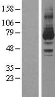 PKC iota (PRKCI) Human Over-expression Lysates NM_002740