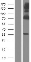 cGKI (PRKG1) Human Over-expression Lysates NM_001098512
