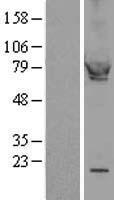 cGKI (PRKG1) Human Over-expression Lysates NM_006258