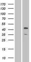 JNK1 (MAPK8) Human Over-expression Lysates NM_139046