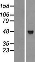 JNK1 (MAPK8) Human Over-expression Lysates NM_139047