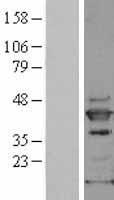 SAPK4 (MAPK13) Human Over-expression Lysates NM_002754