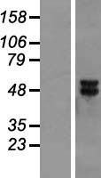 MEK5 (MAP2K5) Human Over-expression Lysates NM_145160
