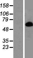 ls005618 prolactin receptor prlr human over expression lysates nm 000949 wb testing 1