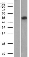 Protein C (PROC) Human Over-expression Lysates NM_000312