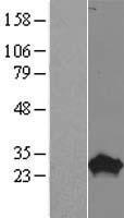 PROP1 Human Over-expression Lysates NM_006261