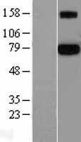 Protein S (PROS1) Human Over-expression Lysates NM_000313