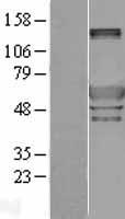 Peripherin (PRPH) Human Over-expression Lysates NM_006262