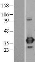 PRPS1 Human Over-expression Lysates NM_002764