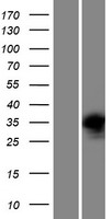 PRPS2 Human Over-expression Lysates NM_001039091
